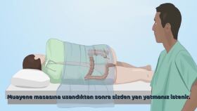 Kolonoskopi Animasyonu