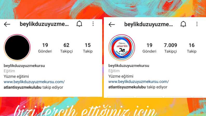 Takipçi Artırma