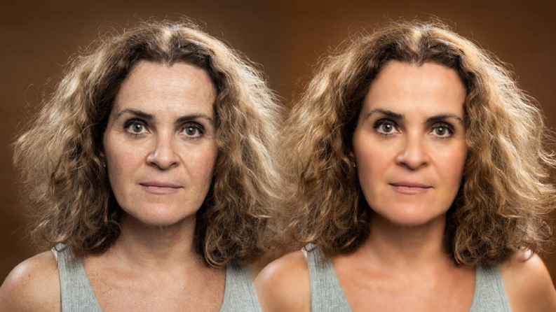 Skin retouch işlemi