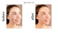 Retouch 