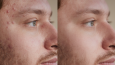 Retouch işlemi