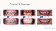 FLY Dental Clinic – Kurumsal Web Sitesi