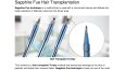 Sapphire Fue Hair Transplantation