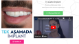 Sağlık Sektörü Diş Kliniği Landing Page