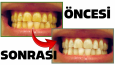 GÖZ ALICI FOTOĞRAF MANİPÜLASYONLARI