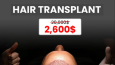 Hair Transplant Meta Add for Natural Clinic