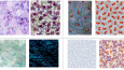 PATTERN DESIGN