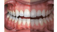 Uygulama için 3D Görünümlü Medikal Vücut İkonları