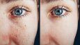 Retouch / Editing