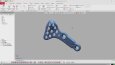 ortopedik implant