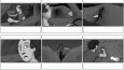 Storyboard