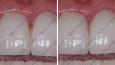 Diş Kliniğini Sosyal Medya Yönetimi