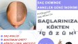 Etkileyici post-story tasarımları 