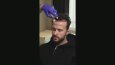 DR. OSMAN GÜN İÇİN YAPTIĞIMIZ SAÇ EKİMİ ÇEKİMLERİ