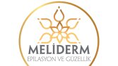 İş örneğim