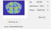 Derin Öğrenme ile MRI Hastalık Teşhisi: Masaüstü Uygulaması