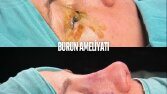 Sosyal Medya Tasarımı