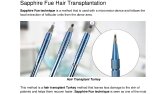Sapphire Fue Hair Transplantation