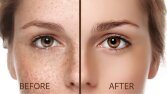 RETOUCH