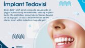 Diş Kliniği ve sağlık post tasarılarımız