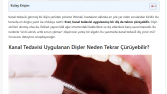 Dentvital – Kanal Tedavisi Üzerine SEO Uyumlu Tanıtım Yazısı