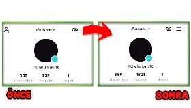 Tiktok Takipçi