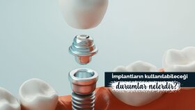 İş örneğim