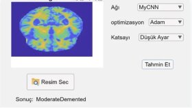 Derin Öğrenme ile MRI Hastalık Teşhisi: Masaüstü Uygulaması