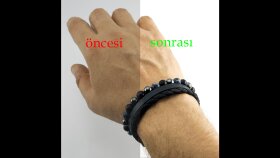 Fotoğraflarda cilt düzeltmesi