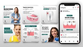 My Dental Sosyal Medya Tasarımları