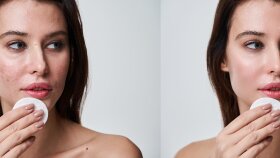 fotoğraflarınızdaki istenmeyen kusurları kapatabilirim