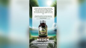 sosyal medya hesaplarınız için post hazırlayabilirim