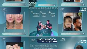 Hair clinic sosyal medya tasarımları