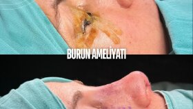 Sosyal Medya Tasarımı