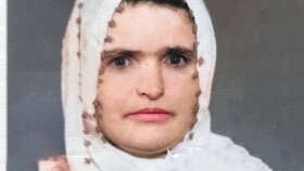 Fotoğraf onarımı