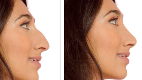 Photoshop İle Sizi daha Güzel/Yakışıklı Gösterebilirim