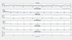EEG signal processing