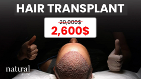 Hair Transplant Meta Add for Natural Clinic