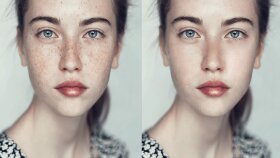Fotoğraflarınız da Sivilce ve leke Silme İşlemi yaparım