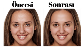 Yüz Retouch