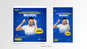 Sosyal Medya Reklam Post & Story