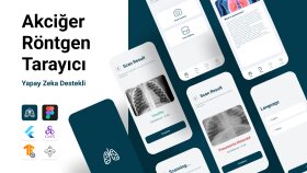 Yapay Zeka Destekli Akciğer Röntgen Tarayıcı