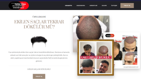 Saç Ekimi - Kurumsal Web Sitesi
