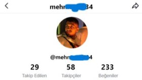 Tiktok Takipçi İşlemi