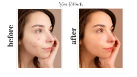 Retouch 