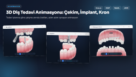 Plandan Üretilen 3D Diş Tedavi Animasyonu