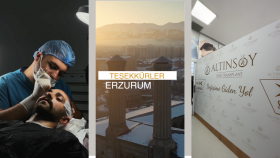 Reels Videoları
