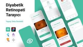 Yapay Zeka Destekli Retina Tarayıcı