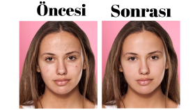 Yüz Retouch
