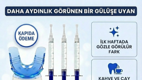 mağazanızda dönüşüm oranınızı yükseltiyorum